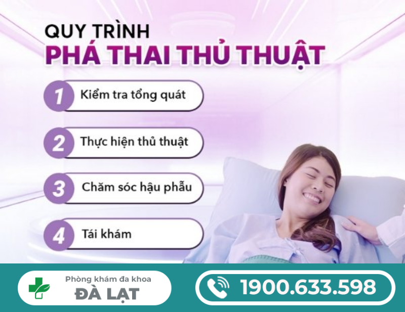 Hình ảnh minh họa